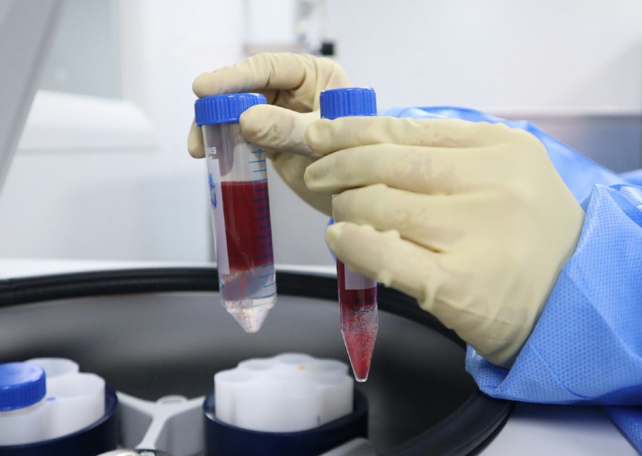 Cell-Based Therapy